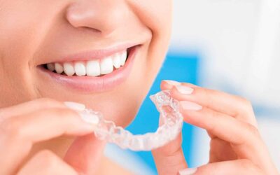 Smile Brighter: Exclusive Invisalign Special Offer Inside!