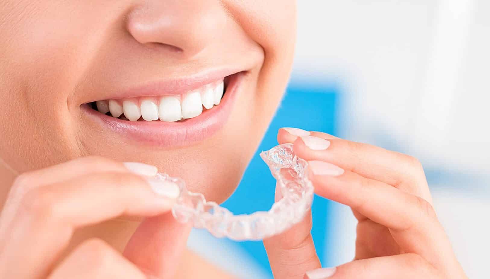 Invisalign