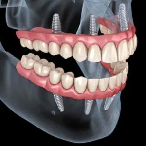 jaw-image
