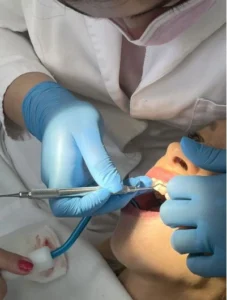 teeth-clean