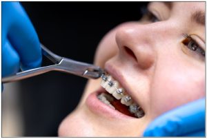 orthodontics in general dentistry
