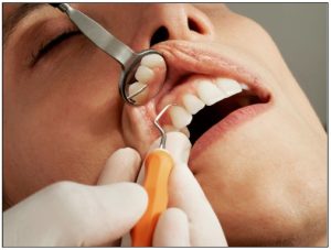 teeth cleaning in general dentistry