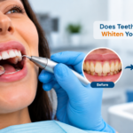 Does Teeth Cleaning Whiten Your Teeth?