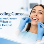 bleeding gums