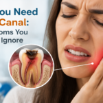 Signs You Need a Root Canal: 10 Symptoms You Shouldn’t Ignore