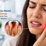 Signs You Need a Root Canal: 10 Symptoms You Shouldn’t Ignore
