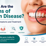 What Are the Signs of Gum Disease Stages Symptoms and Treatment