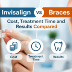 Invisalign vs Braces: Cost, Treatment Time and Results Compared