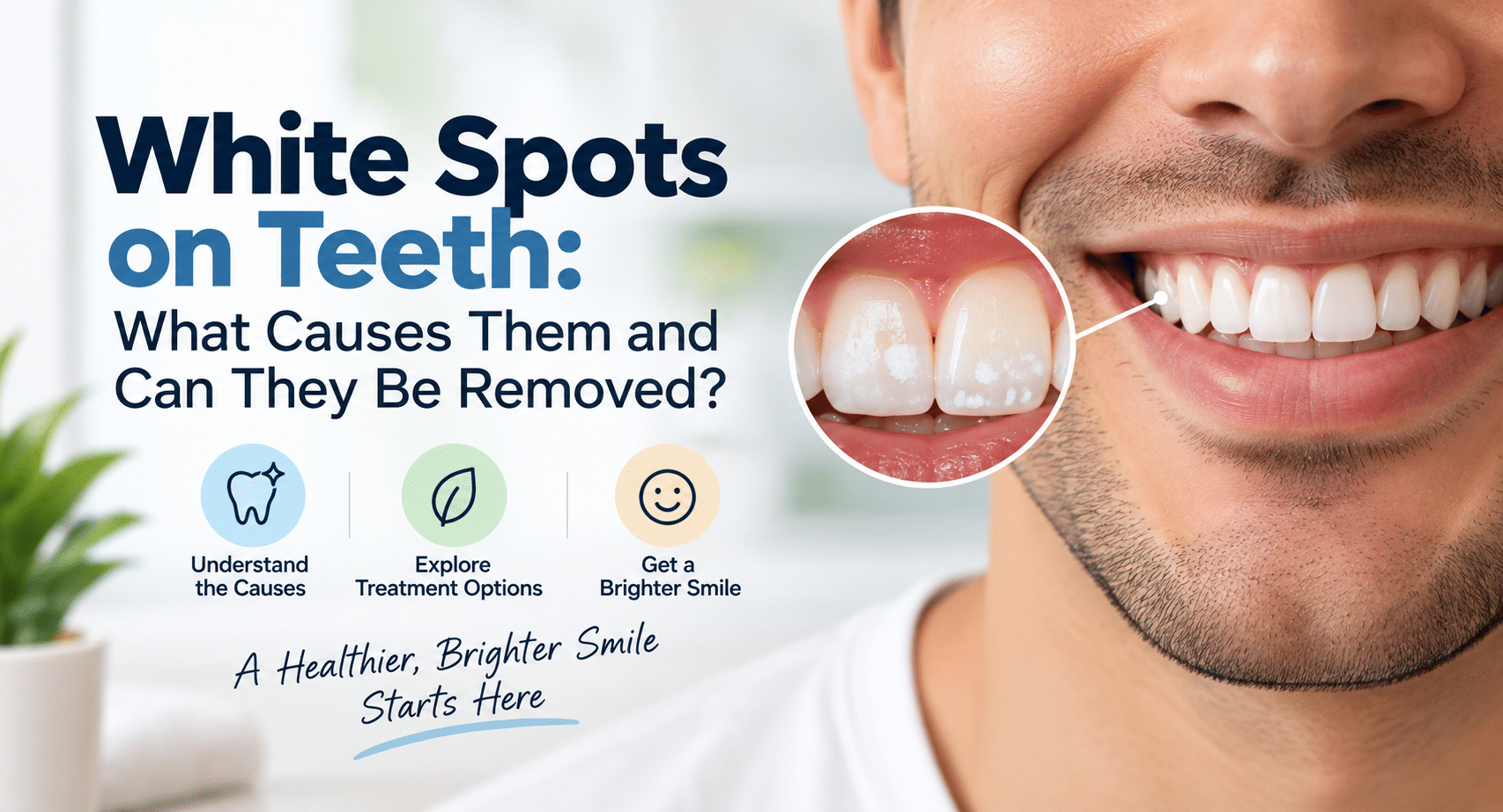 White Spots on Teeth