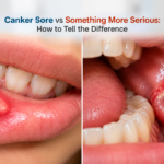 Canker Sore vs Something More Serious: How to Tell the Difference