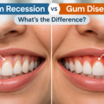 Gum Recession vs Gum Disease: What’s the Difference?