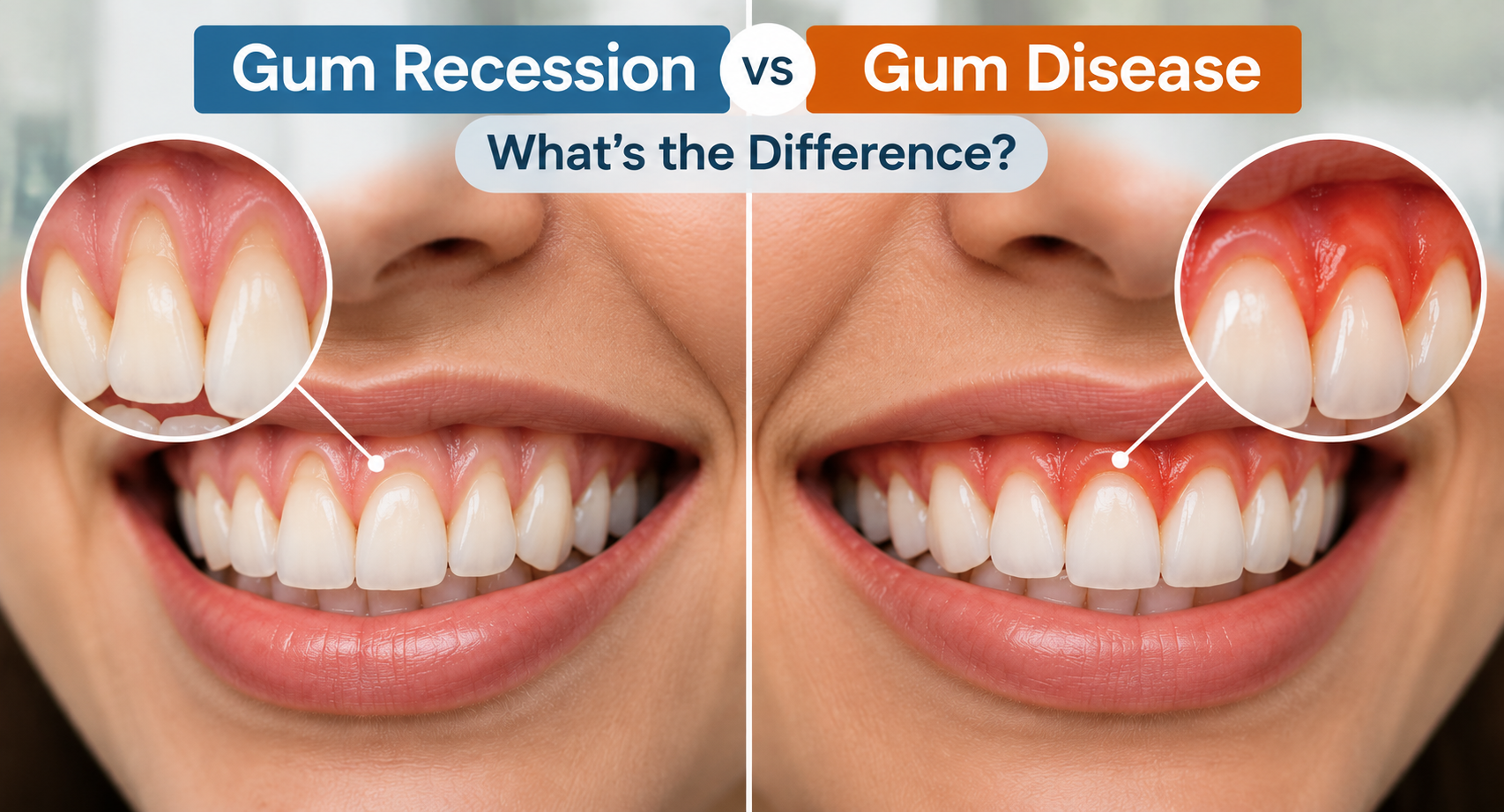 Gum Recession vs Gum Disease: What’s the Difference?