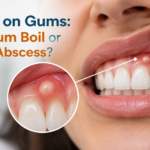Pimple on Gums: Is It a Gum Boil or Dental Abscess?