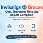 Invisalign vs Braces