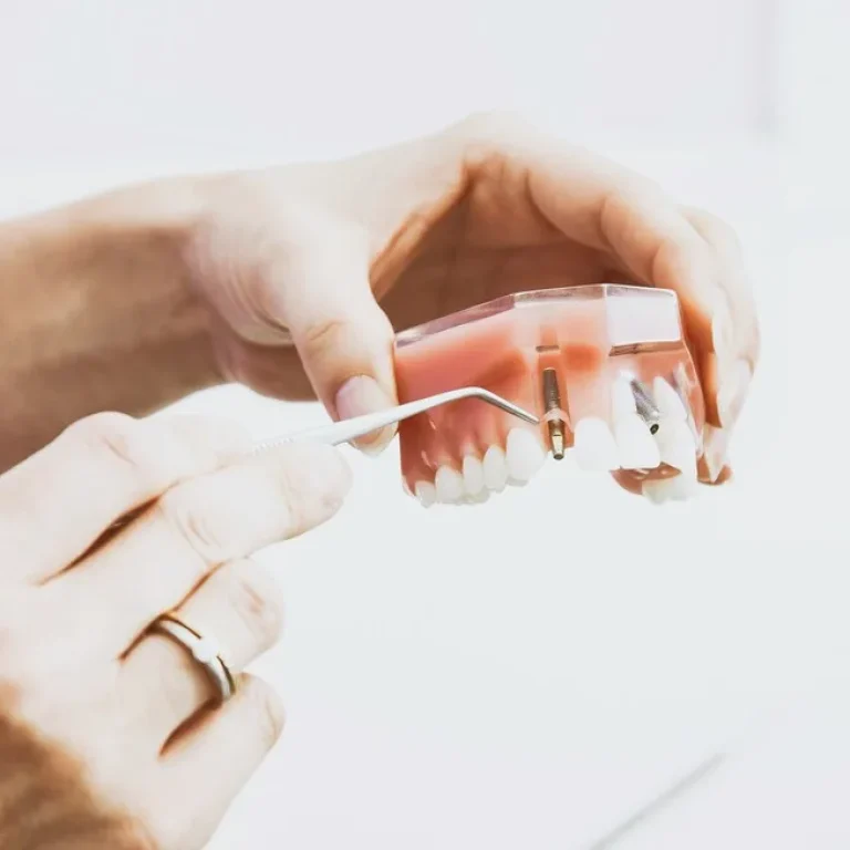 Dental Expense Cover