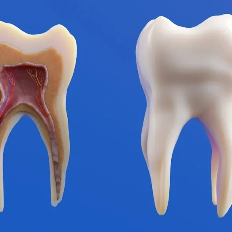 Tooth sensitivity