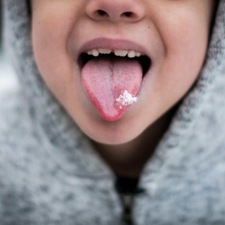 age for dental impalnt