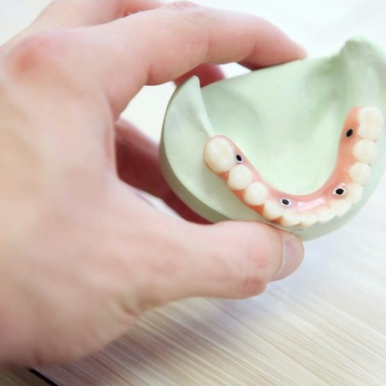 dental maintain
