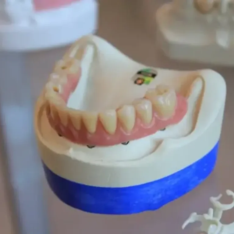 full dentures