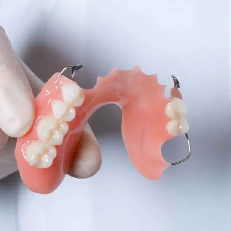root_Denture-photos_premium-acrylic-denture-1-1024x681-1 (2)